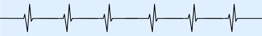 A graphic of a heart-beat chart