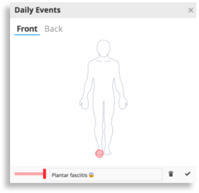 The injury tracking screen in SportTracks endurance sports software