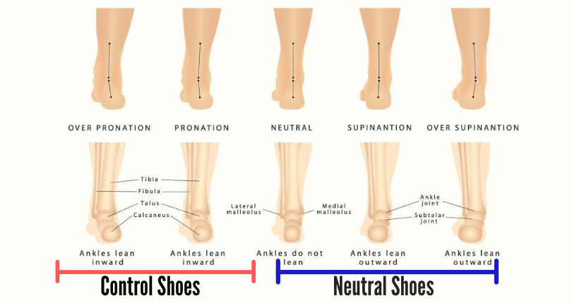 A graphic chart showing pronation, neutral, and supination of runner's feet and ankles